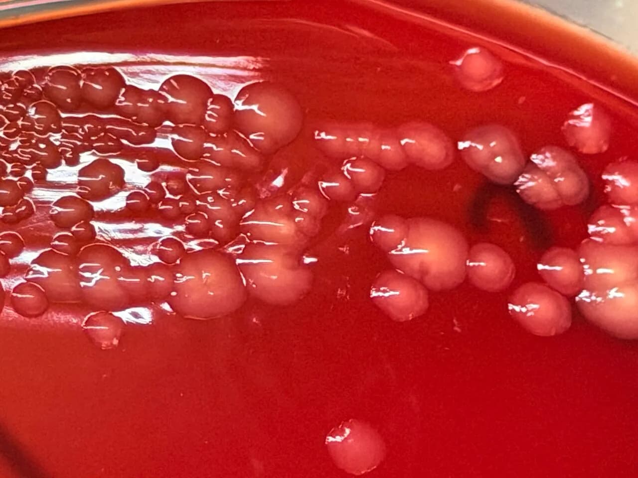 Pseudomonas putida colonies growing on a blood agar plate
