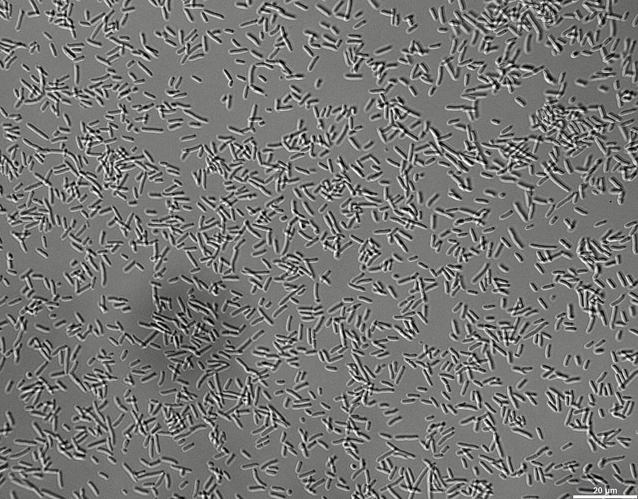 Microscope image of a Pseudomonas putida culture wet mount