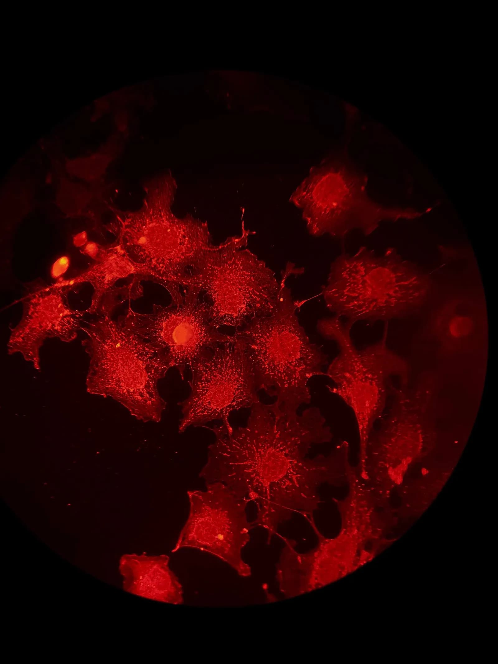 Cells viewed through a fluorescence microscope, with a protein shown in red.